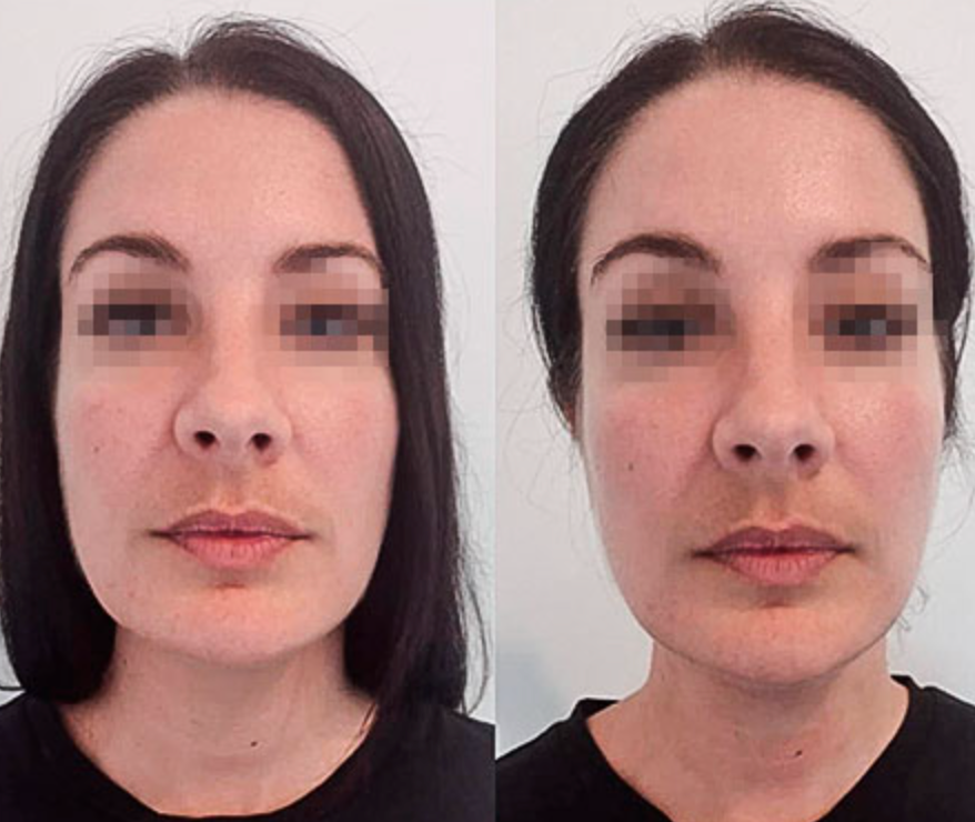 Solenya Entwässerungstropfen