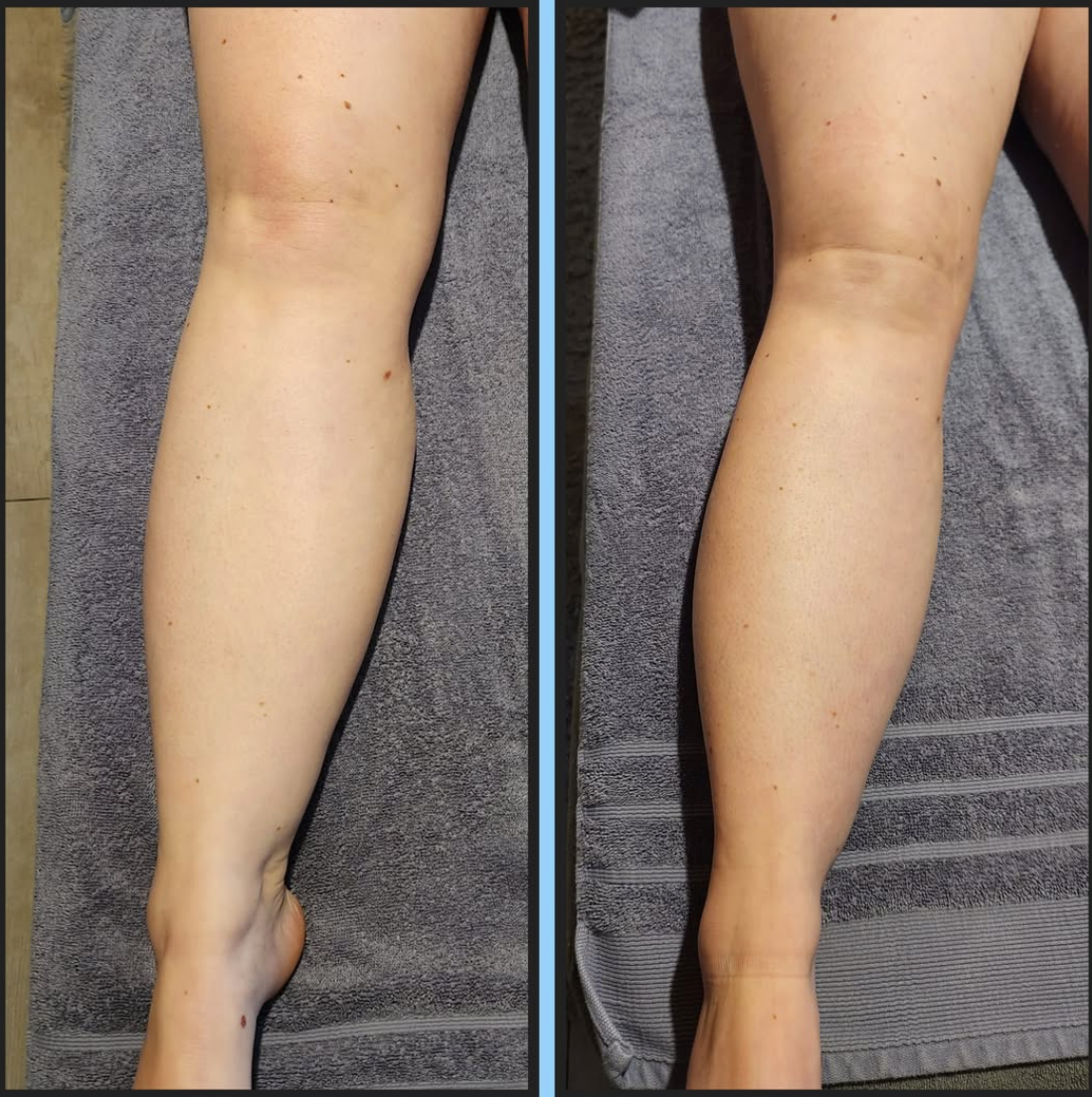 Solenya Entwässerungstropfen